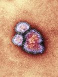 Adenovirus Particles And Bacterium, TEM-Hazel Appleton-Photographic Print