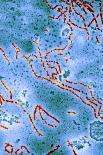 Measles Virus Particles, TEM-Hazel Appleton-Framed Photographic Print