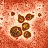 Adenovirus Particles And Bacterium, TEM-Hazel Appleton-Photographic Print