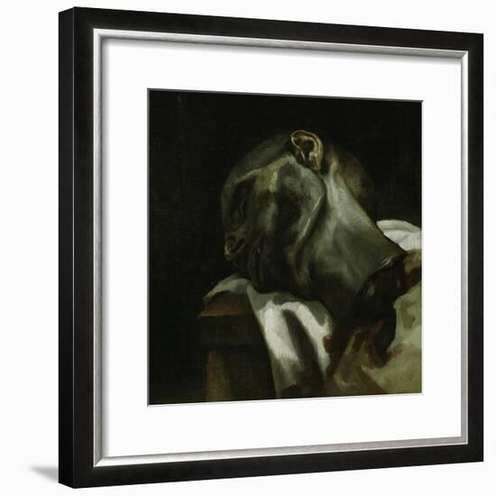 Head of a Guillotined Man, 1818-19-Theodore Gericault-Framed Giclee Print