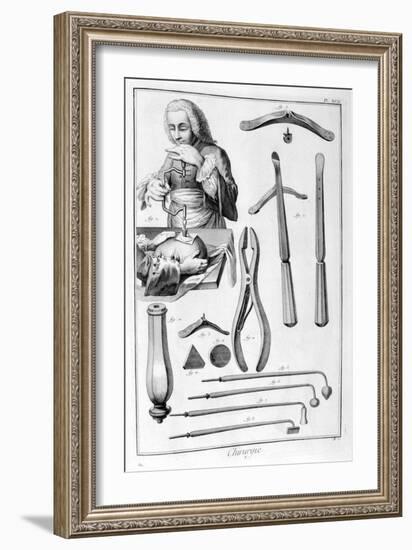 Head Surgery, 1751-1777-Denis Diderot-Framed Giclee Print