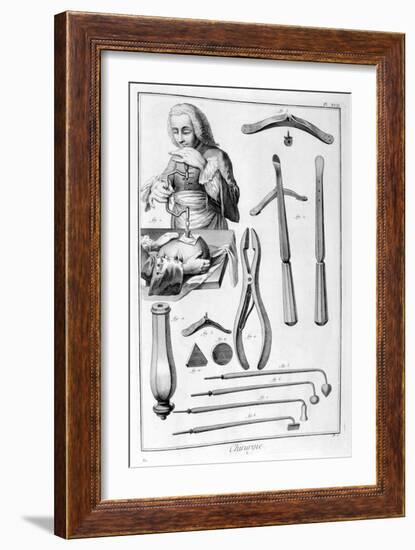 Head Surgery, 1751-1777-Denis Diderot-Framed Giclee Print