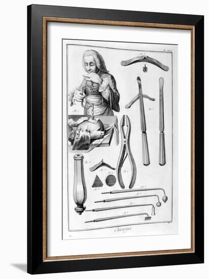 Head Surgery, 1751-1777-Denis Diderot-Framed Giclee Print