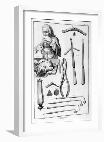 Head Surgery, 1751-1777-Denis Diderot-Framed Giclee Print