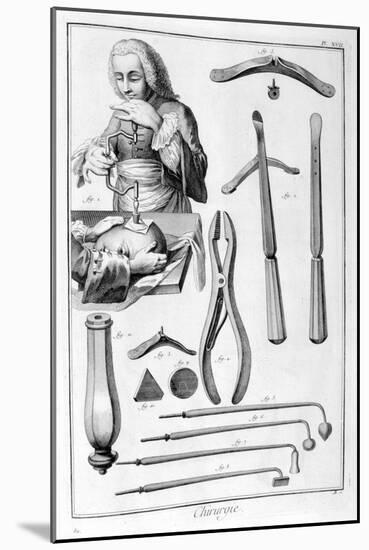 Head Surgery, 1751-1777-Denis Diderot-Mounted Giclee Print