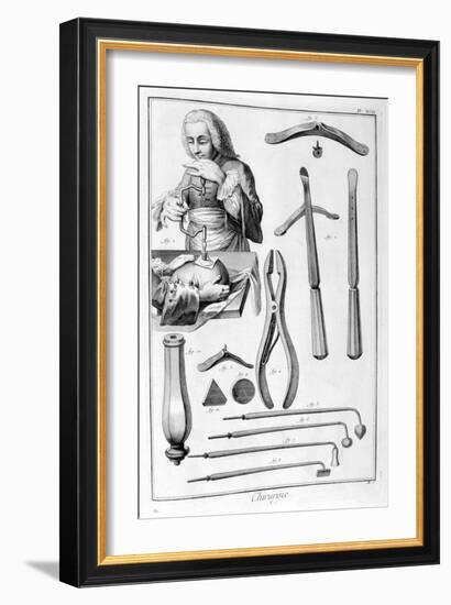 Head Surgery, 1751-1777-Denis Diderot-Framed Giclee Print