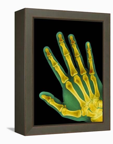 Healthy Adult Hand, X-ray-Science Photo Library-Framed Premier Image Canvas