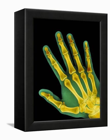 Healthy Adult Hand, X-ray-Science Photo Library-Framed Premier Image Canvas