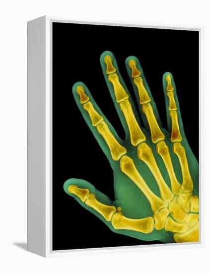 Healthy Adult Hand, X-ray-Science Photo Library-Framed Premier Image Canvas