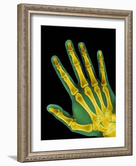 Healthy Adult Hand, X-ray-Science Photo Library-Framed Photographic Print