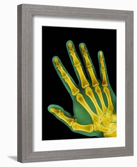 Healthy Adult Hand, X-ray-Science Photo Library-Framed Photographic Print