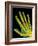 Healthy Adult Hand, X-ray-Science Photo Library-Framed Photographic Print