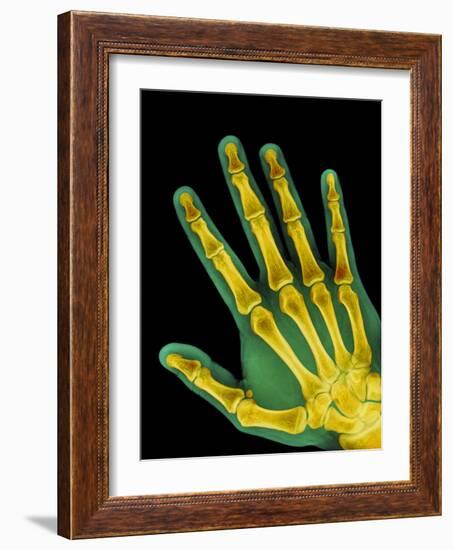 Healthy Adult Hand, X-ray-Science Photo Library-Framed Photographic Print