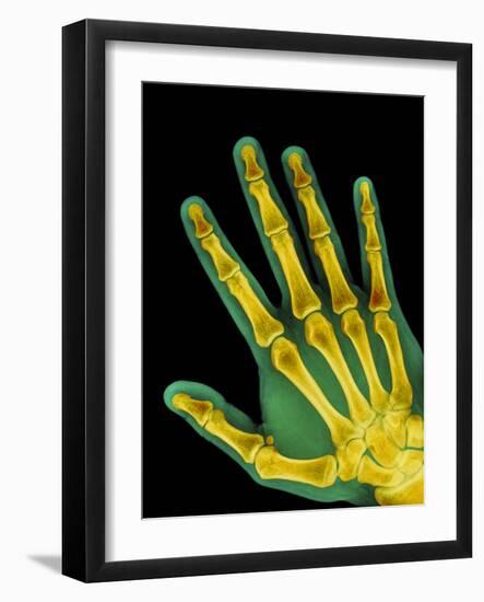 Healthy Adult Hand, X-ray-Science Photo Library-Framed Photographic Print