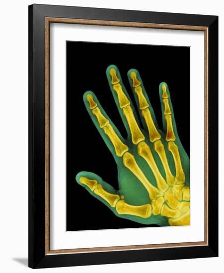 Healthy Adult Hand, X-ray-Science Photo Library-Framed Photographic Print