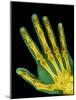 Healthy Adult Hand, X-ray-Science Photo Library-Mounted Photographic Print