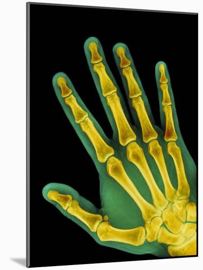 Healthy Adult Hand, X-ray-Science Photo Library-Mounted Photographic Print
