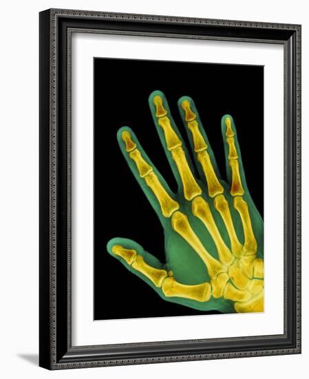 Healthy Adult Hand, X-ray-Science Photo Library-Framed Photographic Print