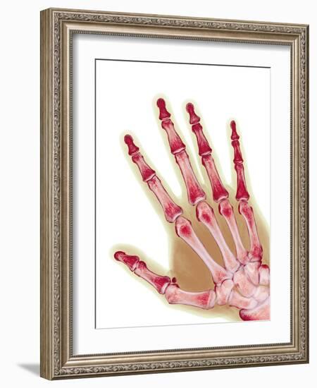 Healthy Adult Hand, X-ray-Science Photo Library-Framed Photographic Print