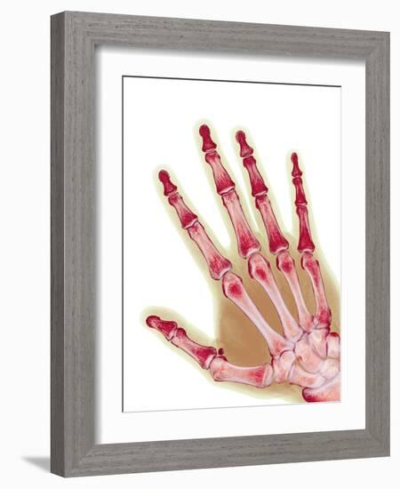 Healthy Adult Hand, X-ray-Science Photo Library-Framed Photographic Print