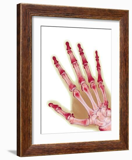 Healthy Adult Hand, X-ray-Science Photo Library-Framed Photographic Print