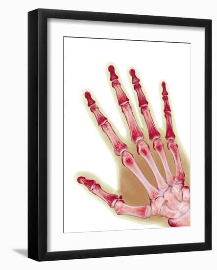 Healthy Adult Hand, X-ray-Science Photo Library-Framed Photographic Print