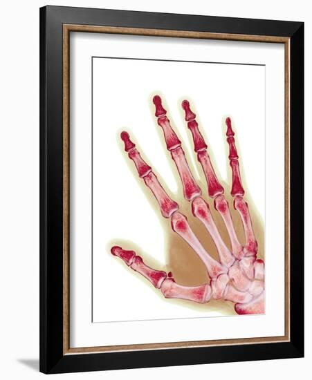 Healthy Adult Hand, X-ray-Science Photo Library-Framed Photographic Print