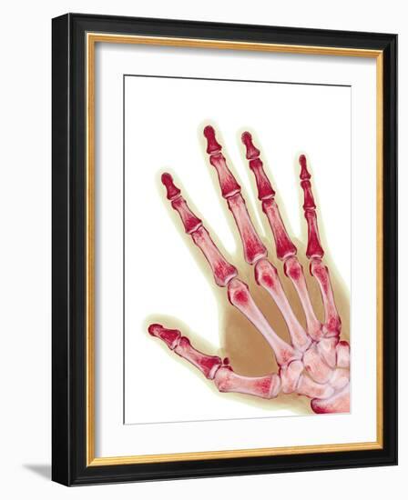 Healthy Adult Hand, X-ray-Science Photo Library-Framed Photographic Print