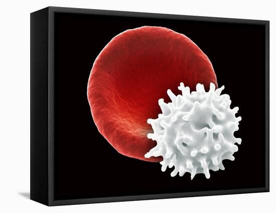 Healthy And Crenated Red Blood Cells, SEM-Steve Gschmeissner-Framed Premier Image Canvas