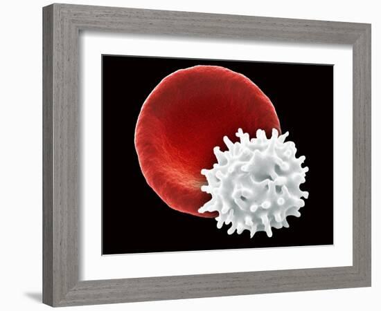 Healthy And Crenated Red Blood Cells, SEM-Steve Gschmeissner-Framed Photographic Print