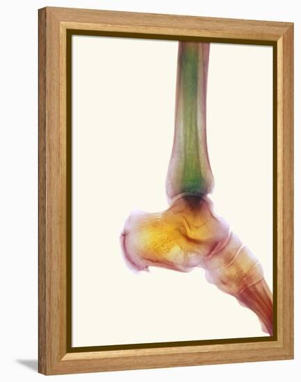 Healthy Ankle, X-ray-Science Photo Library-Framed Premier Image Canvas