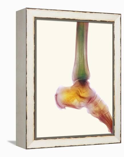 Healthy Ankle, X-ray-Science Photo Library-Framed Premier Image Canvas