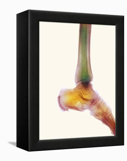 Healthy Ankle, X-ray-Science Photo Library-Framed Premier Image Canvas