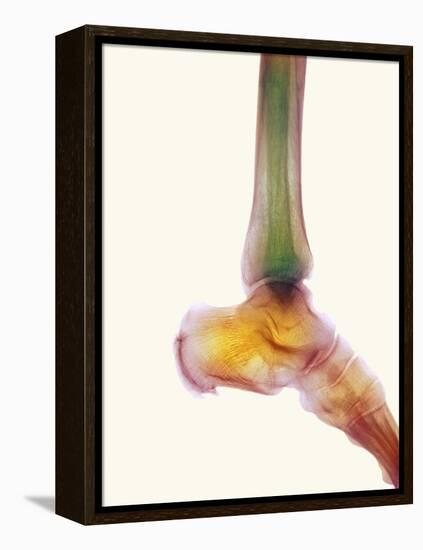 Healthy Ankle, X-ray-Science Photo Library-Framed Premier Image Canvas