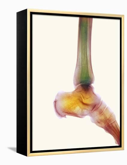 Healthy Ankle, X-ray-Science Photo Library-Framed Premier Image Canvas