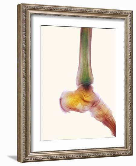 Healthy Ankle, X-ray-Science Photo Library-Framed Photographic Print