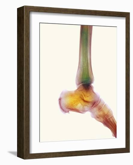 Healthy Ankle, X-ray-Science Photo Library-Framed Photographic Print