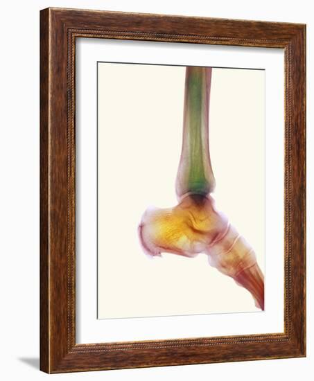 Healthy Ankle, X-ray-Science Photo Library-Framed Photographic Print