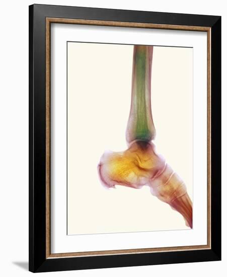 Healthy Ankle, X-ray-Science Photo Library-Framed Photographic Print