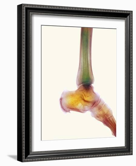 Healthy Ankle, X-ray-Science Photo Library-Framed Photographic Print