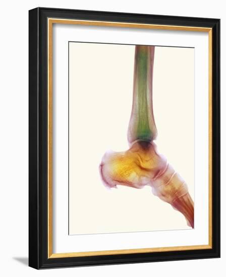 Healthy Ankle, X-ray-Science Photo Library-Framed Photographic Print