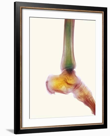 Healthy Ankle, X-ray-Science Photo Library-Framed Photographic Print