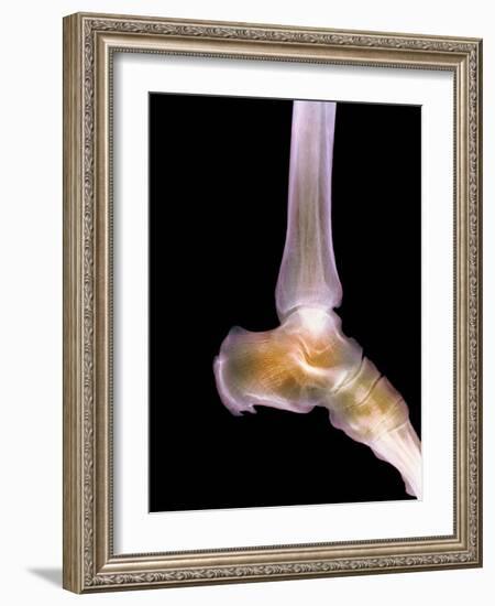 Healthy Ankle, X-ray-Science Photo Library-Framed Photographic Print