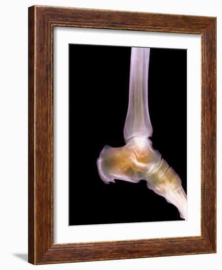 Healthy Ankle, X-ray-Science Photo Library-Framed Photographic Print