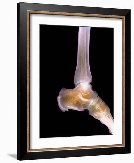 Healthy Ankle, X-ray-Science Photo Library-Framed Photographic Print