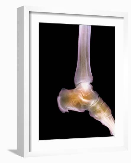 Healthy Ankle, X-ray-Science Photo Library-Framed Photographic Print