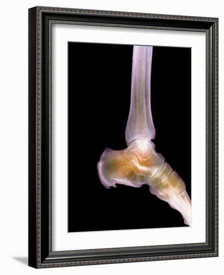 Healthy Ankle, X-ray-Science Photo Library-Framed Photographic Print