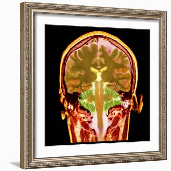 Healthy Brain, MRI Scan-Science Photo Library-Framed Premium Photographic Print