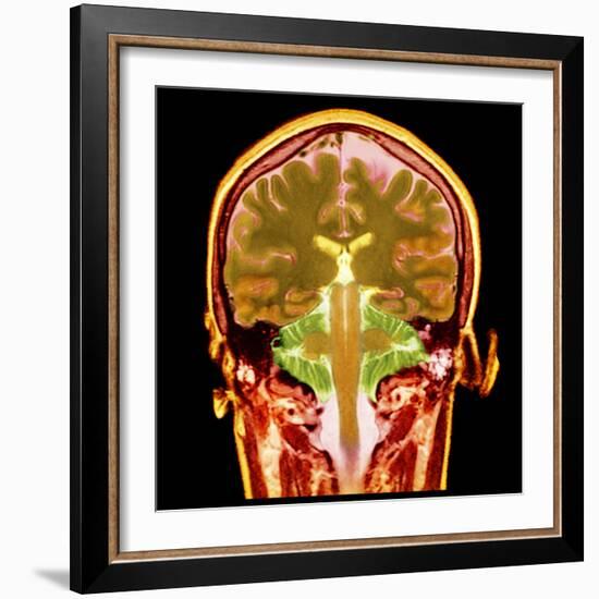 Healthy Brain, MRI Scan-Science Photo Library-Framed Premium Photographic Print
