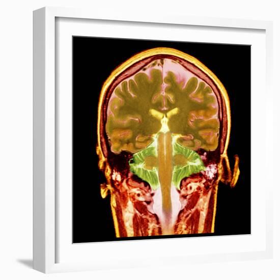 Healthy Brain, MRI Scan-Science Photo Library-Framed Premium Photographic Print